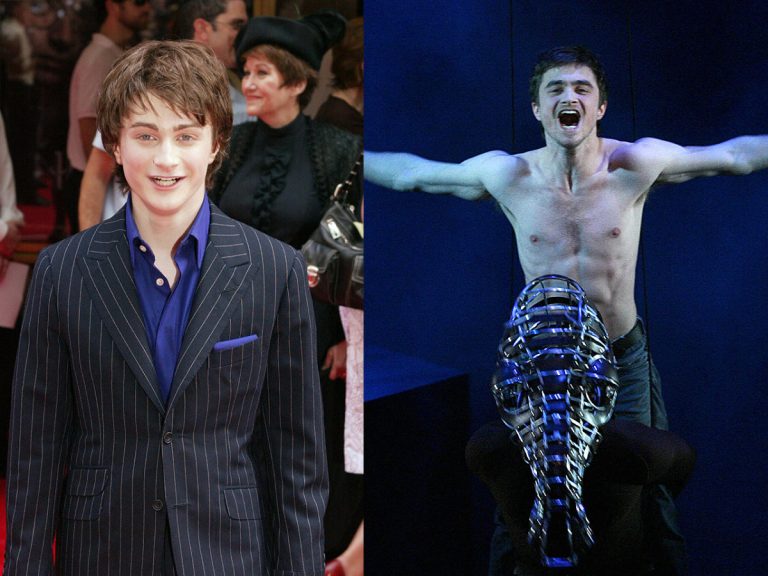 The Harry Potter Cast: Transformations And Physical Challenges